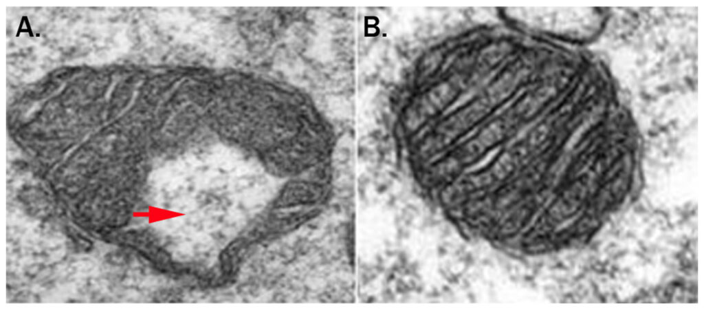 肥満マウス卵母細胞のミトコンドリアの形態